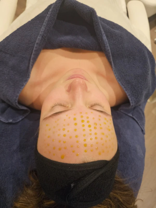 Platinum 2 Fusion Meso