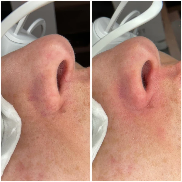 Resultaat Elvii352vp